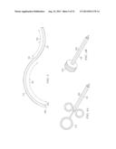 Methods And Devices For Minimally-Invasive Extraocular Delivery Of     Radiation To The Posterior Portion Of The Eye diagram and image