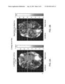 Methods for Treating Psychiatric Disorders Using Light Energy diagram and image