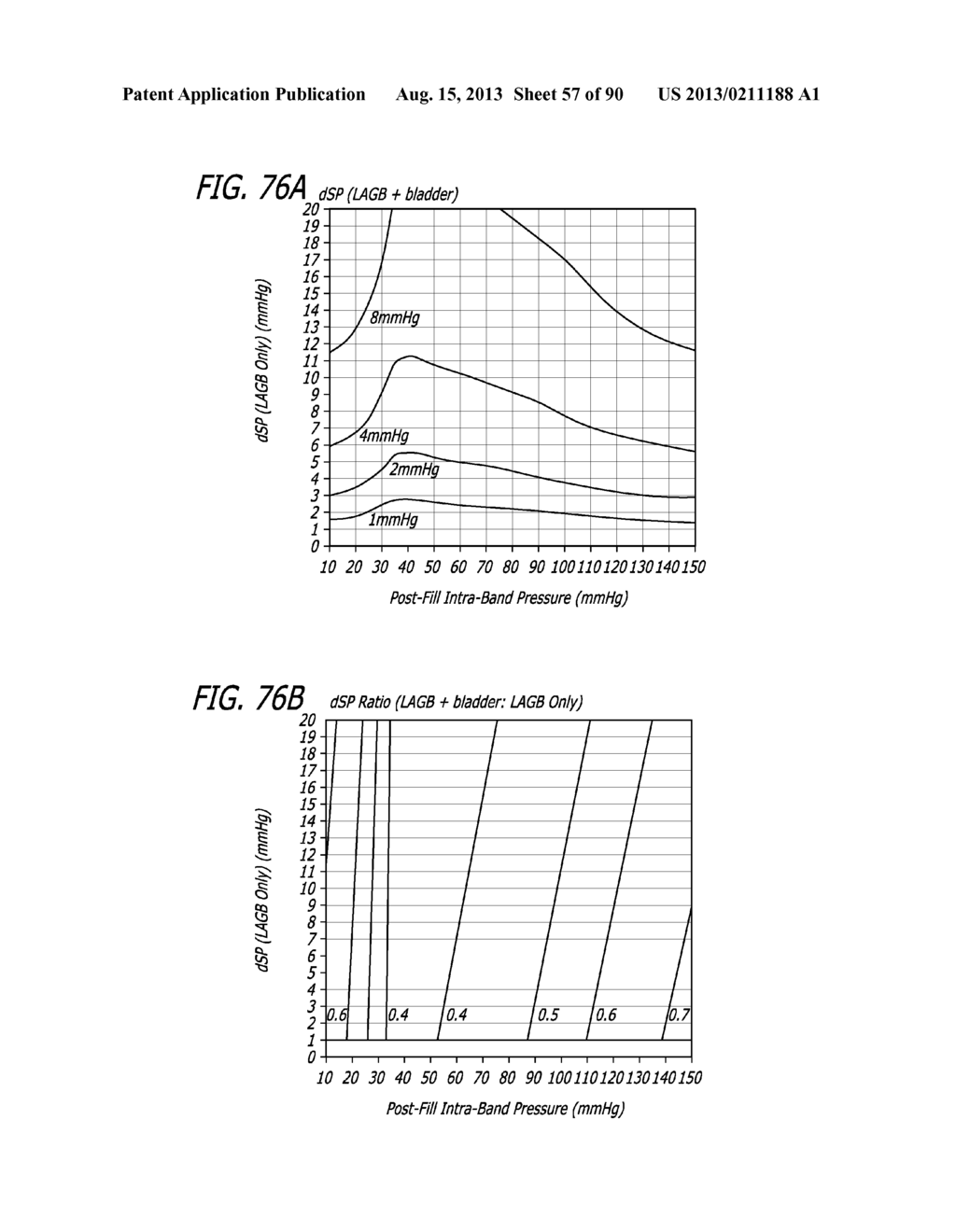 METHOD FOR INCREASING DISTENSIBILITY IN A GASTRIC BAND - diagram, schematic, and image 58