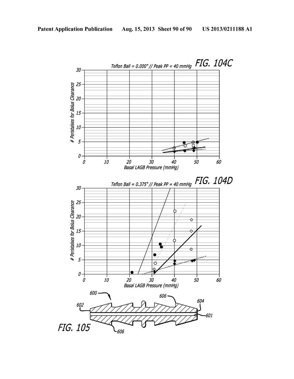 METHOD FOR INCREASING DISTENSIBILITY IN A GASTRIC BAND - diagram, schematic, and image 91