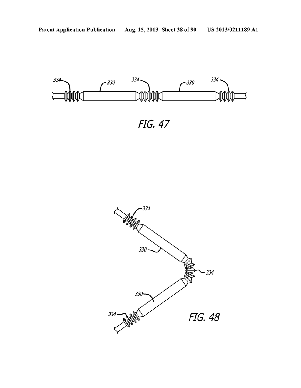 METHOD FOR PROVIDING HIGH BASAL INTRA-LUMINAL PRESSURE USING A GASTRIC     BAND - diagram, schematic, and image 39