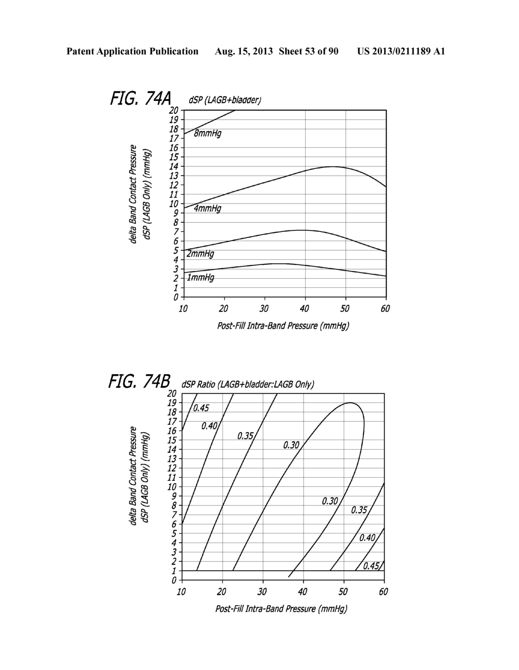 METHOD FOR PROVIDING HIGH BASAL INTRA-LUMINAL PRESSURE USING A GASTRIC     BAND - diagram, schematic, and image 54