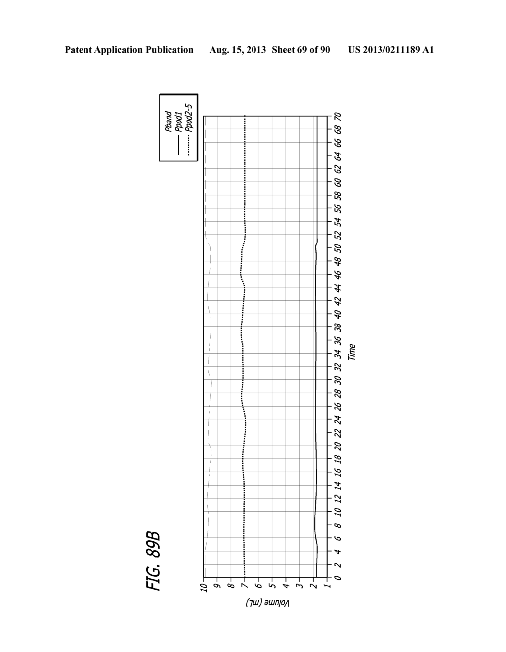 METHOD FOR PROVIDING HIGH BASAL INTRA-LUMINAL PRESSURE USING A GASTRIC     BAND - diagram, schematic, and image 70