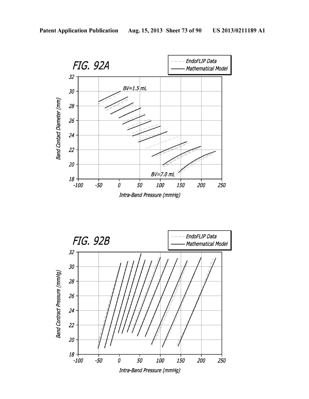 METHOD FOR PROVIDING HIGH BASAL INTRA-LUMINAL PRESSURE USING A GASTRIC     BAND - diagram, schematic, and image 74