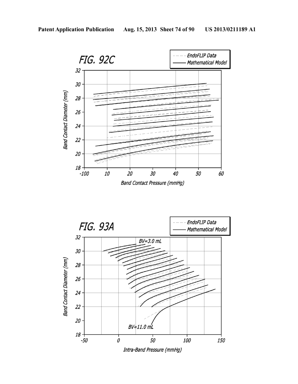 METHOD FOR PROVIDING HIGH BASAL INTRA-LUMINAL PRESSURE USING A GASTRIC     BAND - diagram, schematic, and image 75