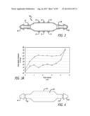 METHOD FOR INCREASING DISTENSIBILITY IN A GASTRIC BAND diagram and image