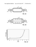 METHOD FOR INCREASING DISTENSIBILITY IN A GASTRIC BAND diagram and image