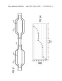 METHOD FOR INCREASING DISTENSIBILITY IN A GASTRIC BAND diagram and image