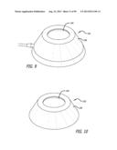 METHOD FOR INCREASING DISTENSIBILITY IN A GASTRIC BAND diagram and image