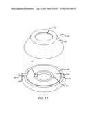 METHOD FOR INCREASING DISTENSIBILITY IN A GASTRIC BAND diagram and image