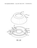 METHOD FOR INCREASING DISTENSIBILITY IN A GASTRIC BAND diagram and image