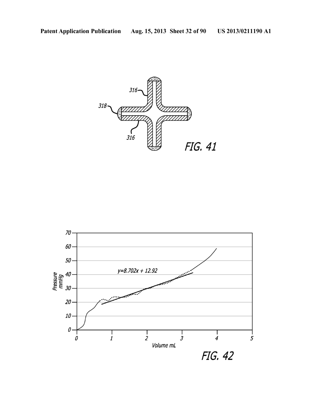 METHOD FOR INCREASING DISTENSIBILITY IN A GASTRIC BAND - diagram, schematic, and image 33