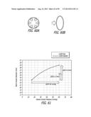 METHOD FOR INCREASING DISTENSIBILITY IN A GASTRIC BAND diagram and image