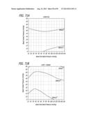 METHOD FOR INCREASING DISTENSIBILITY IN A GASTRIC BAND diagram and image