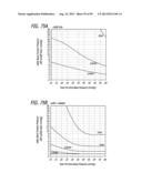 METHOD FOR INCREASING DISTENSIBILITY IN A GASTRIC BAND diagram and image