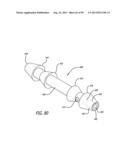 METHOD FOR INCREASING DISTENSIBILITY IN A GASTRIC BAND diagram and image