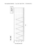 METHOD FOR INCREASING DISTENSIBILITY IN A GASTRIC BAND diagram and image