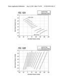 METHOD FOR INCREASING DISTENSIBILITY IN A GASTRIC BAND diagram and image