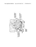 APPARATUS FOR POSTERIOR PELVIC FLOOR REPAIR diagram and image