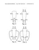 APPARATUS FOR POSTERIOR PELVIC FLOOR REPAIR diagram and image