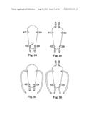 APPARATUS FOR POSTERIOR PELVIC FLOOR REPAIR diagram and image