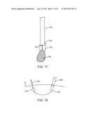 APPARATUS AND METHODS FOR HYBRID ENDOSCOPIC AND LAPAROSCOPIC SURGERY diagram and image