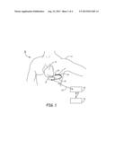 IMPLANTABLE MEDICAL DEVICE ORIENTATION CHANGE DETECTION diagram and image