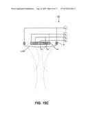 METHODS FOR FACE AND NECK LIFTS diagram and image