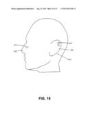 METHODS FOR FACE AND NECK LIFTS diagram and image