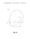 METHODS FOR FACE AND NECK LIFTS diagram and image