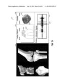 DETERMINATION OF JOINT CONDITION BASED ON VIBRATION ANALYSIS diagram and image