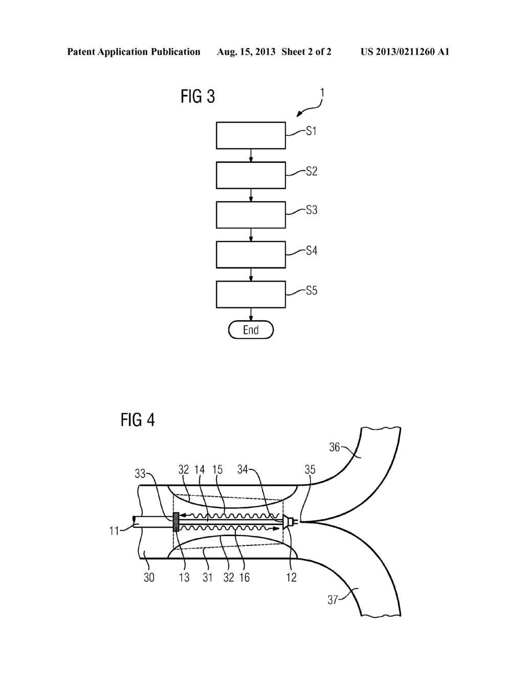 Apparatus and method for minimally invasive length measurement within a     hollow organ - diagram, schematic, and image 03