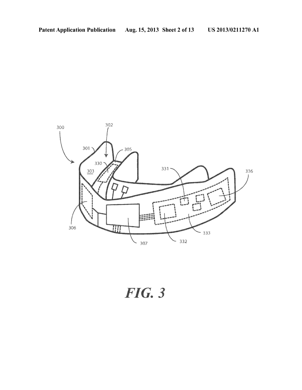 Mouth Guard for Monitoring Body Dynamics and Methods Therefor - diagram, schematic, and image 03