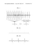 METHOD AND APPARATUS FOR ELIMINATING MOTION ARTIFACTS OF BIO SIGNAL USING     PERSONALIZED BIO SIGNAL PATTERN diagram and image