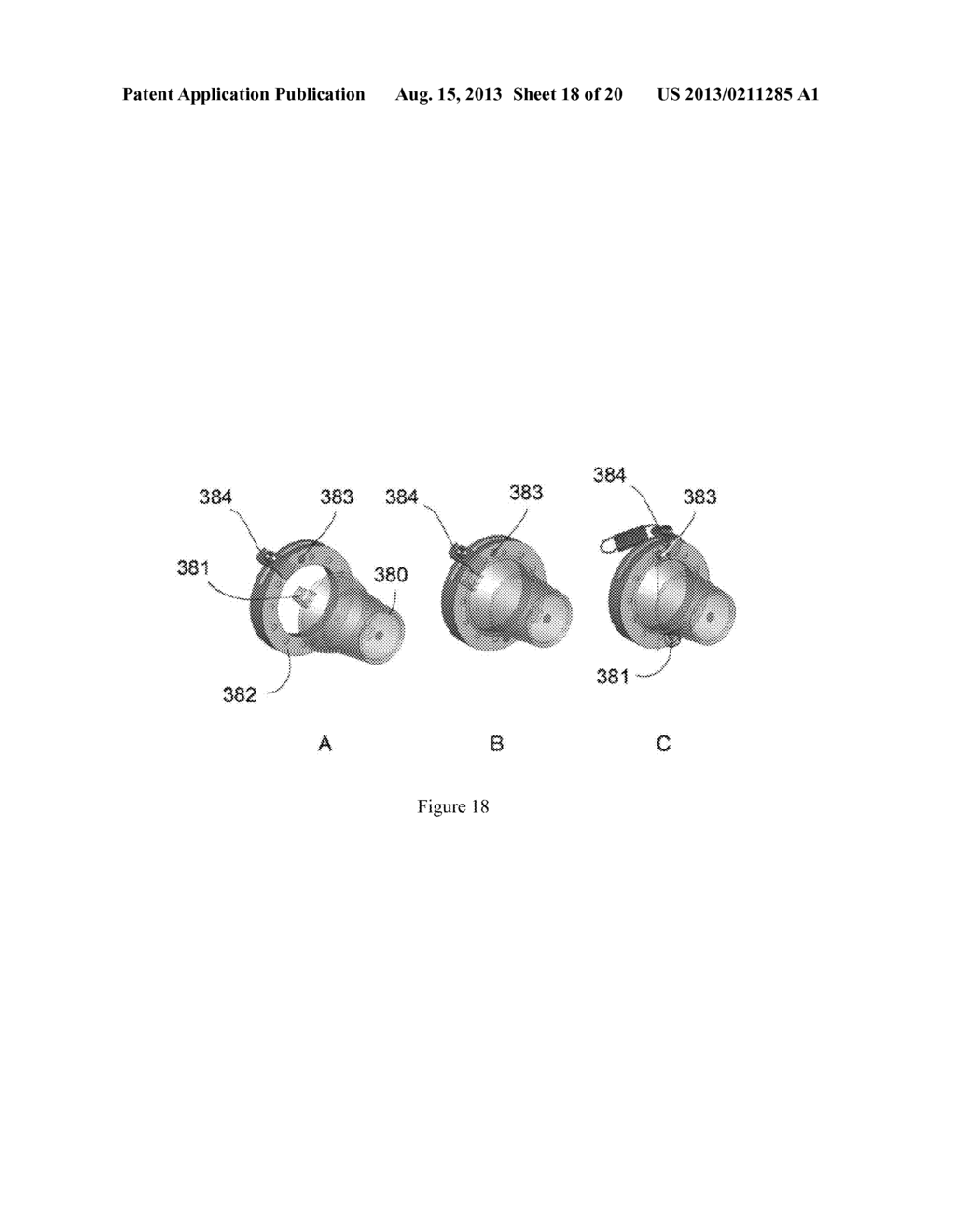 Devices and Methods for Noninvasive Measurement of Intracranial Pressure - diagram, schematic, and image 19