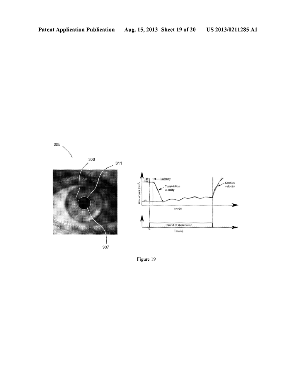 Devices and Methods for Noninvasive Measurement of Intracranial Pressure - diagram, schematic, and image 20