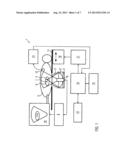 Shock Wave Therapy Device diagram and image