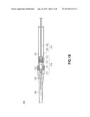 INTRAVENOUS CATHETER SET diagram and image