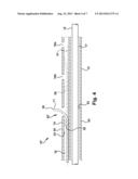 CATHETER ASSEMBLY AND METHOD OF TREATING A VASCULAR DISEASE diagram and image