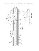 CATHETER ASSEMBLY AND METHOD OF TREATING A VASCULAR DISEASE diagram and image