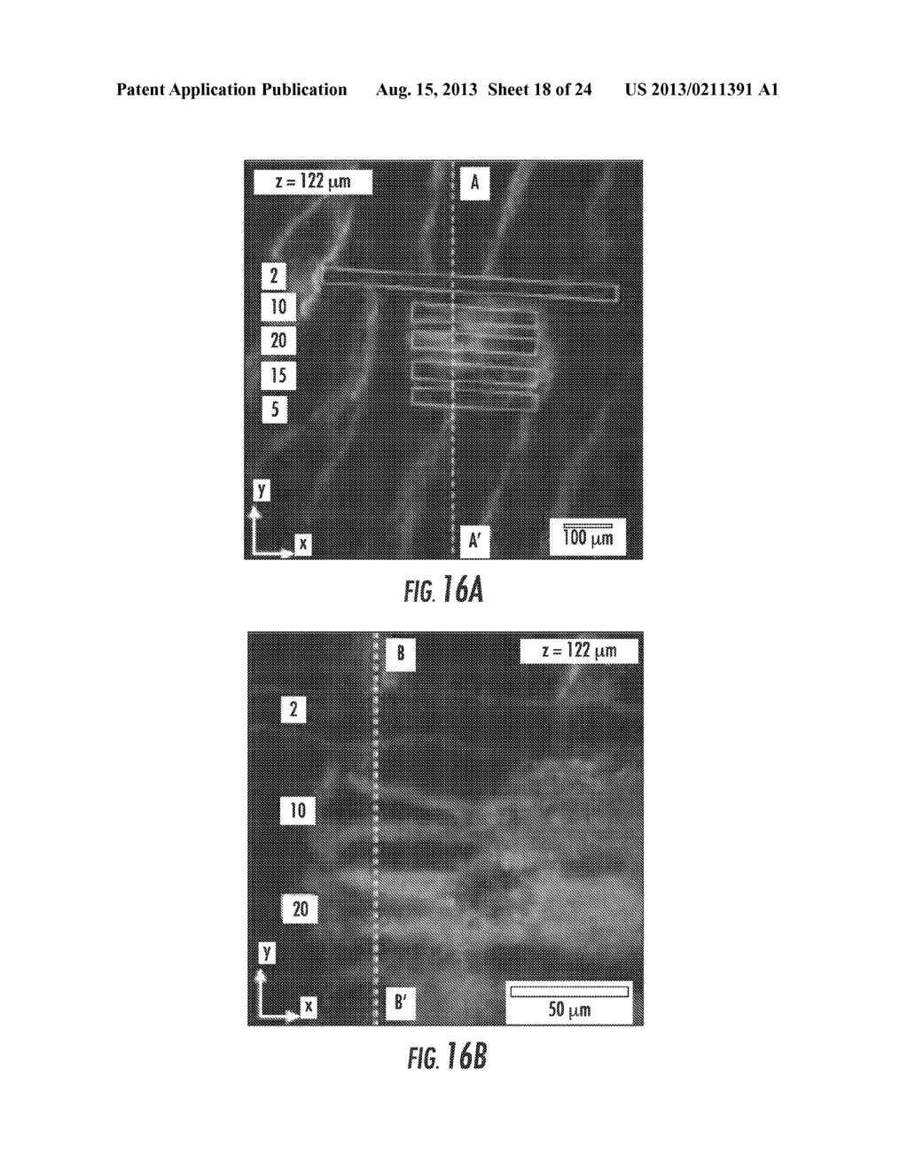 SYSTEMS, DEVICES AND METHODS FOR IMAGING AND SURGERY - diagram, schematic, and image 19