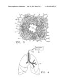 METHODS OF TREATING INFLAMMATION IN AIRWAYS diagram and image