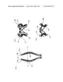 OBSTETRIC FORCEPS diagram and image