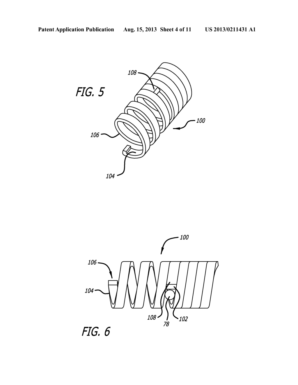 COILED ANCHOR DEVICE - diagram, schematic, and image 05