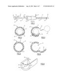 Endoscopic Vessel Dissector With Side Entry diagram and image