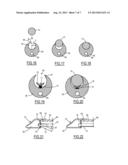 Endoscopic Vessel Dissector With Side Entry diagram and image