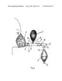 Device for Equalization of the Pressure in the Middle Ear diagram and image