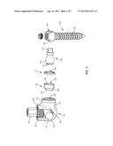 VERTEBRAL IMPLANT AND CONNECTOR diagram and image