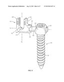 VERTEBRAL IMPLANT AND CONNECTOR diagram and image