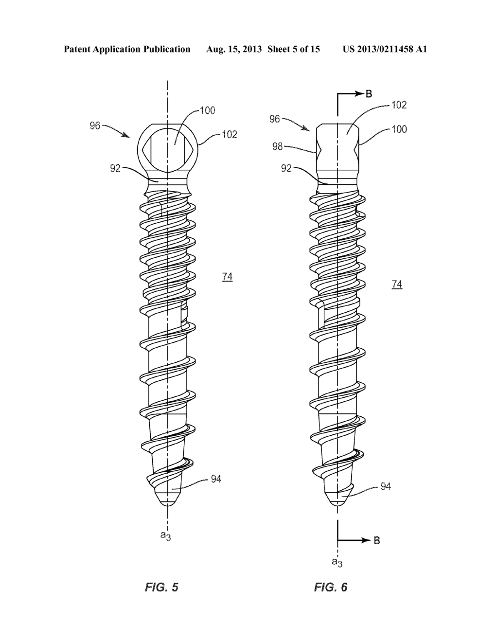 BONE FASTENER AND METHODS OF USE - diagram, schematic, and image 06